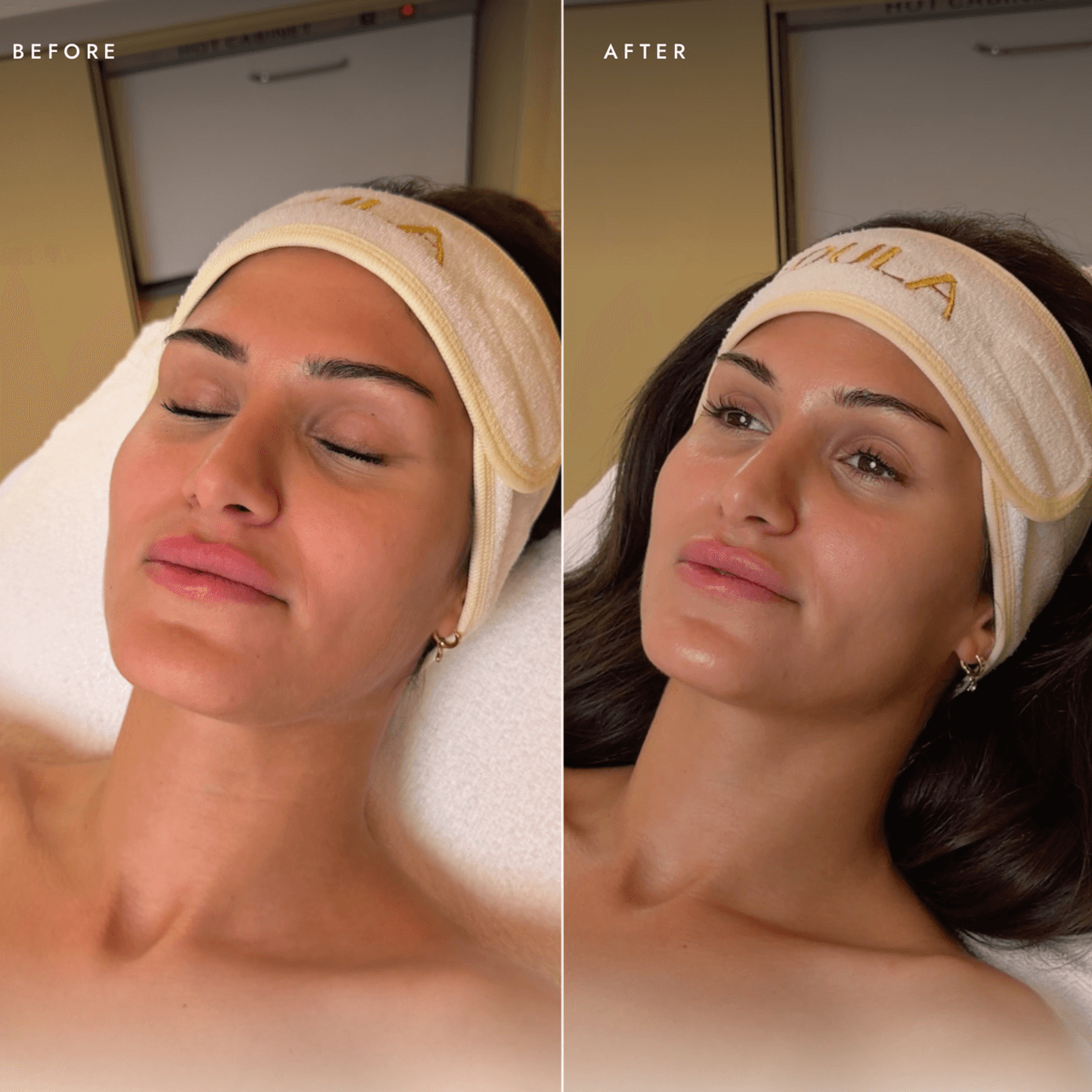Inside the med spa membership Torontonians are booking out
