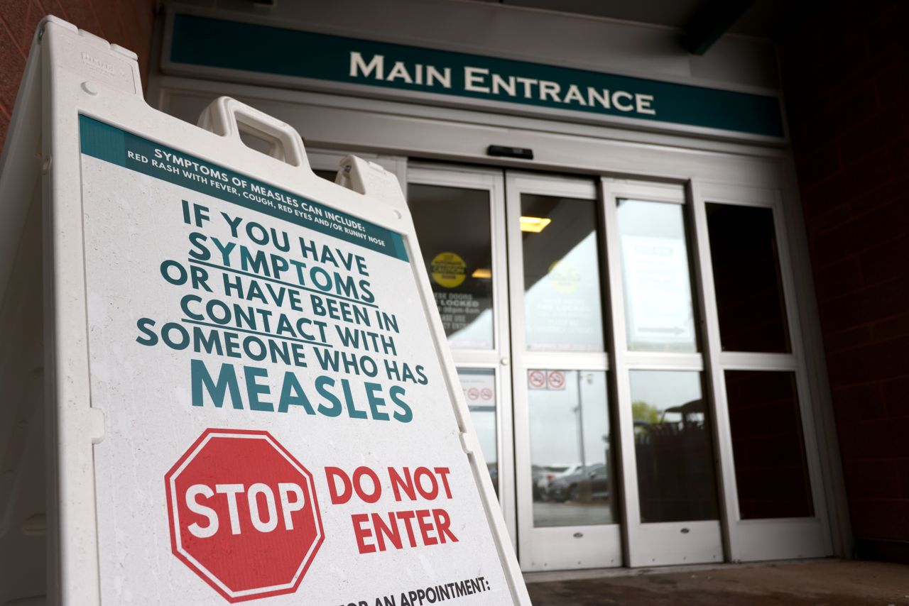 Canada has lost its measles elimination status